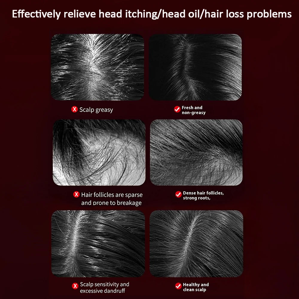 Vibration Scalp Comb with Red Light Therapy & Oil Applicator